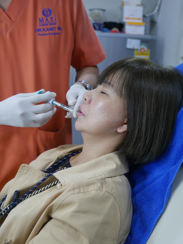 Filler ปาก Filler ปาก