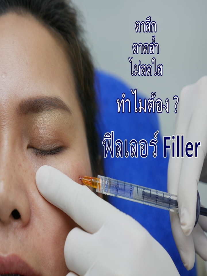 Filler ใต้ตา หมอคณิต1 – Copy Filler ใต้ตา หมอคณิต1 - Copy